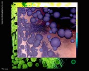 lichen